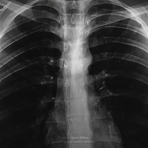 Mary Gu - Если в сердце живет любовь (MARTYNOFF EDIT) 